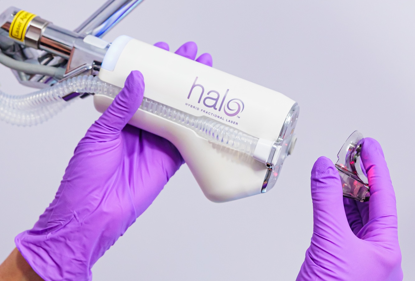 A provider's purple-gloved hands hold the HALO laser applicator and concern-specific prism. This treatment will rejuvenate skin to accentuate the positive results of body contouring near Kalamazoo County.